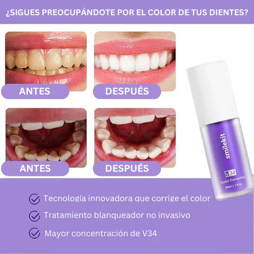 Blanqueador Fix Smile V34™ Original